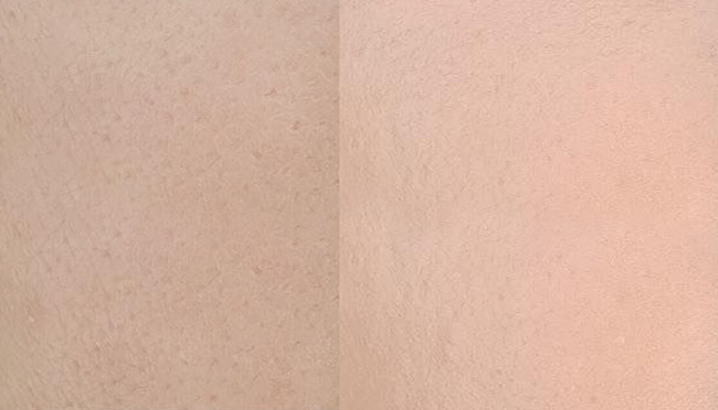 Before and after Milk Makeup Blur Stick