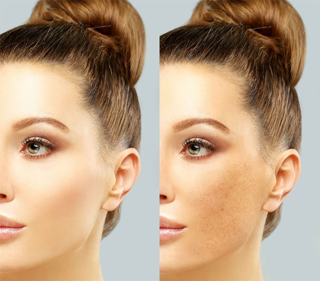 Get Radiant and Even Tone Complexion with Facials for Hyperpigmentation Get Radiant and Even Tone Complexion with Facials for Hyperpigmentation