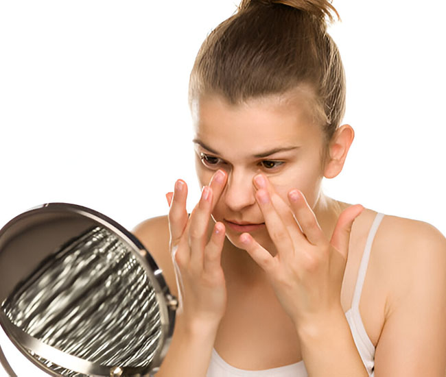 How I Improved My Chronic Dark Circles With Skincare and Lifestyle Changes